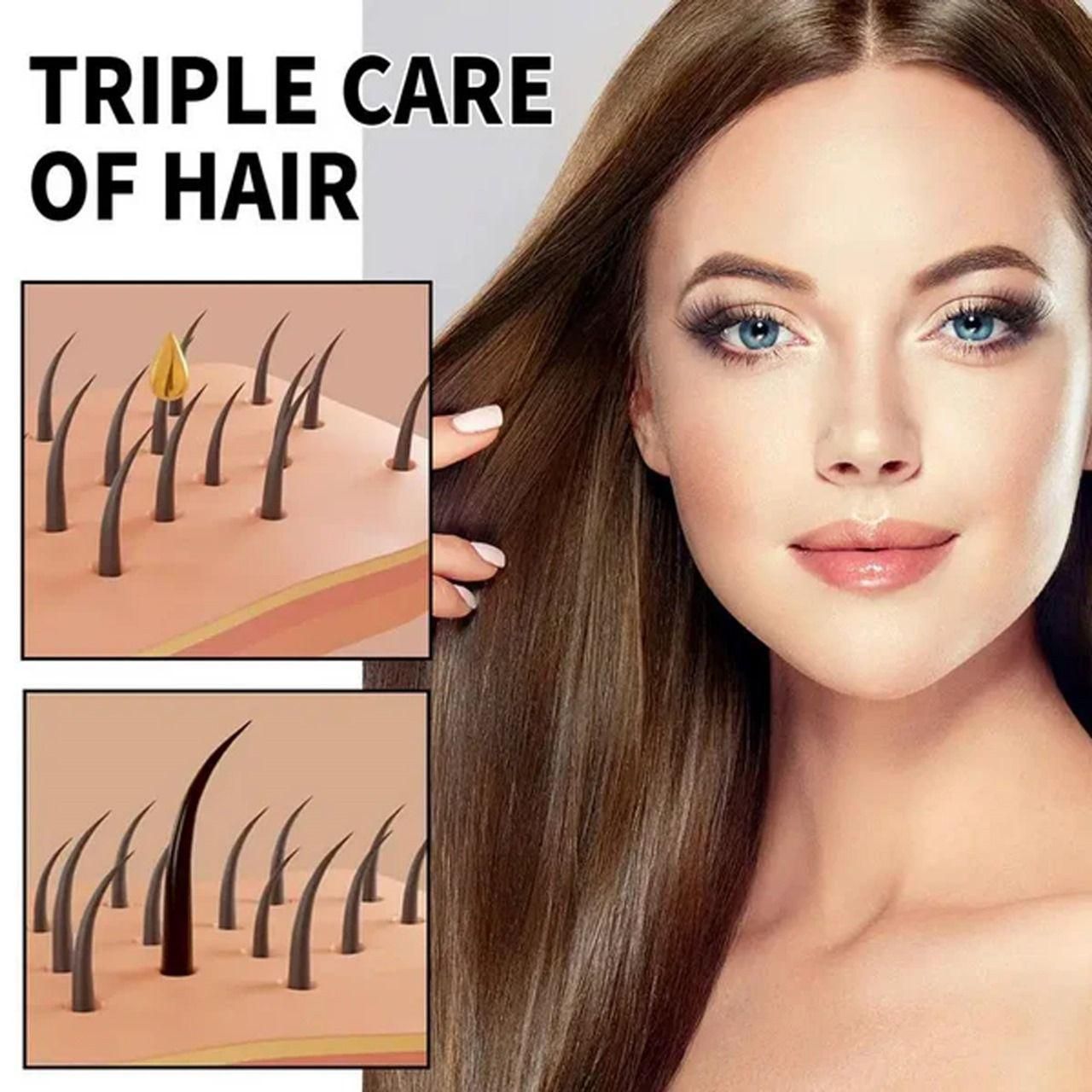 Hair Loss Treatment Serum 30Ml (Pack Of 1)